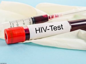 Bigenda Bite Ngo Umuntu Abe Yapimwa Asanganwe Ubwandu Bw'agakoko Gatera SIDA Kandi Ntabwo Afite ‘HIV False Positive'?
