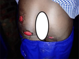 Musanze:Umugore yatwikishije umwana we ipasi ku kibuno amuziza gutaha atinze