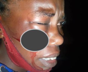 Gicumbi: Polisi yataye muri yombi Umugabo ukekwaho gukubita umukobwa amuziza ko ari “UMUTUTSI”