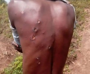 Nyanza:Inkuba yakubise umuturage imusigira ibikomere