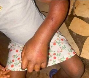 Umugore amerewe nabi azira gukubita cyane umwana amuhora kwiha ibiryo