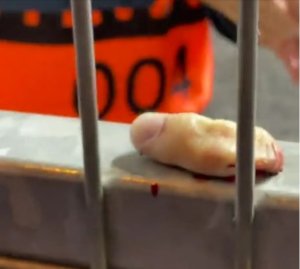 Umufana wa West Ham yacikiye urutoki muri stade kubera kwishimira igitego