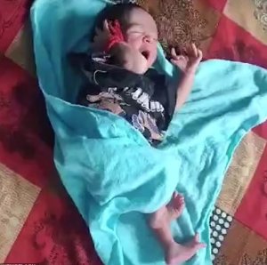 Ababyeyi bo mu Buhinde babyaye umwana ufite intoki 14 n'amano 12 bavuga ko ari imana yazutse